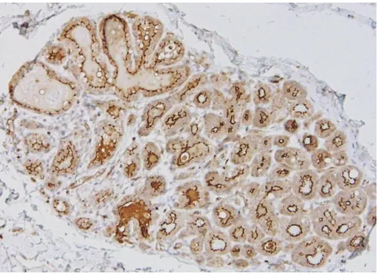 Figura 4 - Glândula mamária não-neoplásica. 