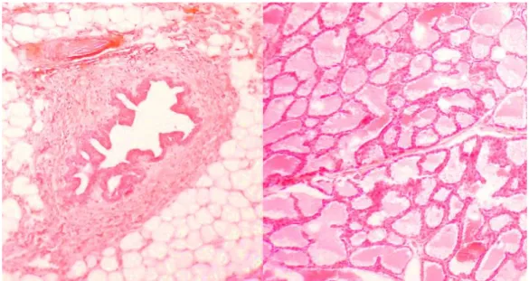 Figura  1.  Estrutura  histológica  da  glândula  mamária  (adaptado  de  Histology-World,  2013)