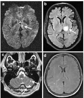 Fig. 1 Magnetic resonance images depicted from all four patients.