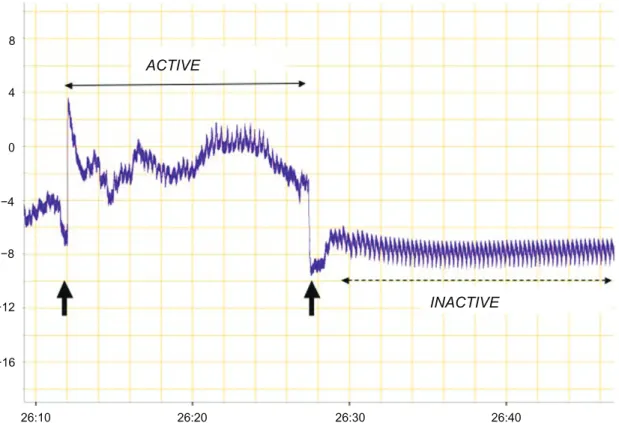 Figure 2 A typical recording of both gill and lateral fin movements, which were then analyzed in terms of the initial and post-treatment activity frequency (Hz) of platy fish