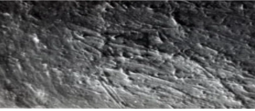Figura 5- Imagem da superfície radicular coberta por smear layer (sem túbulos dentinários abertos), obtida a partir  de um microscópio ótico de varrimento (Addy, 2005)