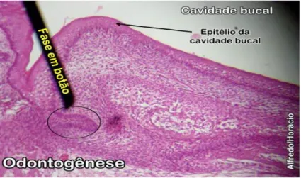 Figura 1- Fase de botão ou iniciação  (Ilustração adaptada de Horácio, A., 2010) 