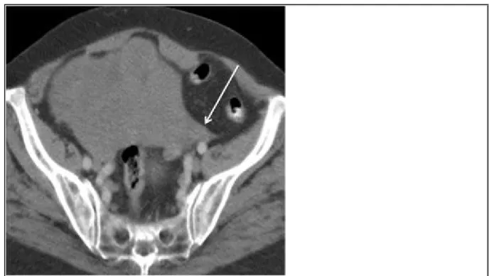 Figure 1 CECT images