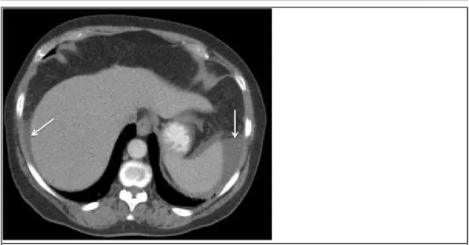 Figure 2 Pelvic MRI