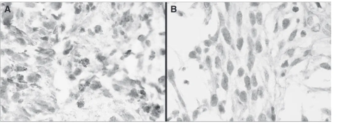 Figure 4 Ideogram and microarray CGH chromosome plots of chromosome 4, in which PDGFRA gene is located, for a case without (A) and other with (B) PDGFRA amplification as defined by QPCR