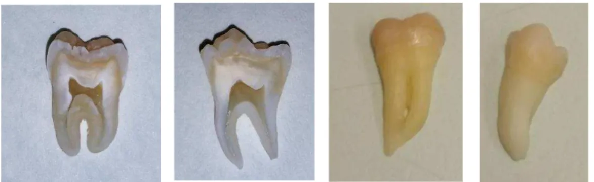 Figura 4  –  Corte no sentido mesio-distal nos dentes