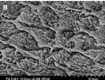 Figura 1 - Imagem obtida por microscopia eletrónica de varrimento do esmalte após aplicação de  ácido ortofosfórico, durante 15 segundos (Perdigão, 2007).