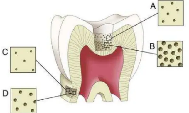Figura  2 - Os túbulos na dentina superficial perto da JAD (A) são mais estreitos e  dispersos em  comparação  com  os  da  dentina  profunda  (B)