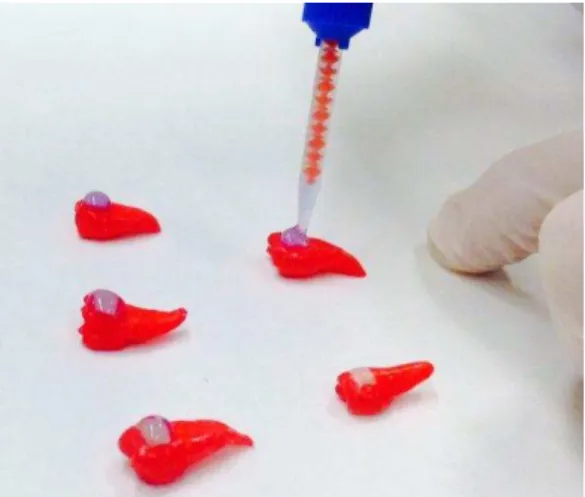 Fig. 7  –  Aplicação do gel de branqueamento nas faces de esmalte. 