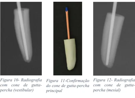Figura 12- Radiografia  com  cone  de   gutta-percha (mesial) Figura  11-Confirmação 