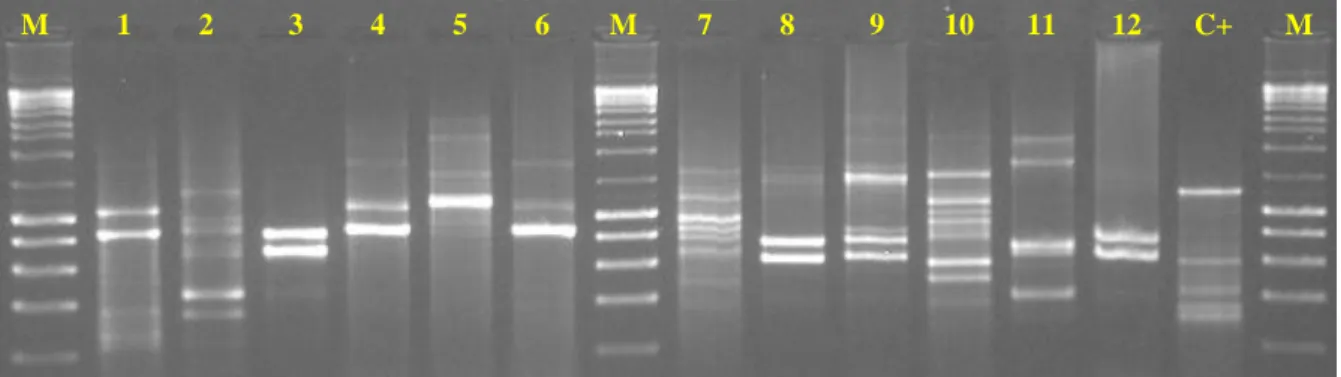 Figura  4  –  Exemplo  de  imagem  de  electroforese  dos  produtos  amplificados  no  PCR  Fingerprinting de isolados de Lactobacillus