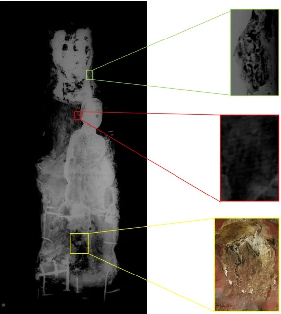 Fig.  38  –   Radiografia  da  escultura  nº  1334.  Autoria  de  Luís  Piorro  (DFR  do  DCR-DGPC)