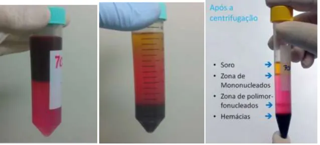 Fig. 6 - Sangue sobre os gradientes de Percoll;     Fig. 7                        Fig
