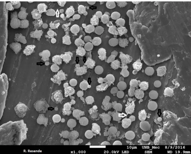 Fig 21 – Neutrófilos sobre superfície de titânio ao MEV com 1.000 x de aumento, mostrando diversidade  morfológica, ativação com grande número de vesículas extracelulares, TNTs e NETs (setas) 