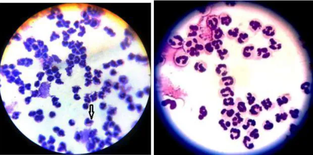 Fig.  25  -  Teste  de  Pureza  do  experimento,  evidenciando alta porcentagem de Neutrófilos na  coloração  Panóptico  a  1.000  X  de  aumento