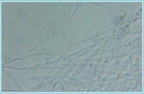 Figura 2 -  Formação de Pseudomicélio de C. albicans 