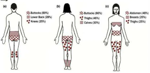 Figura 5: Áreas tipicamente afetadas por EC. (a) machos adolescentes (b) mulheres adolescentes e (c)  mulheres grávidas