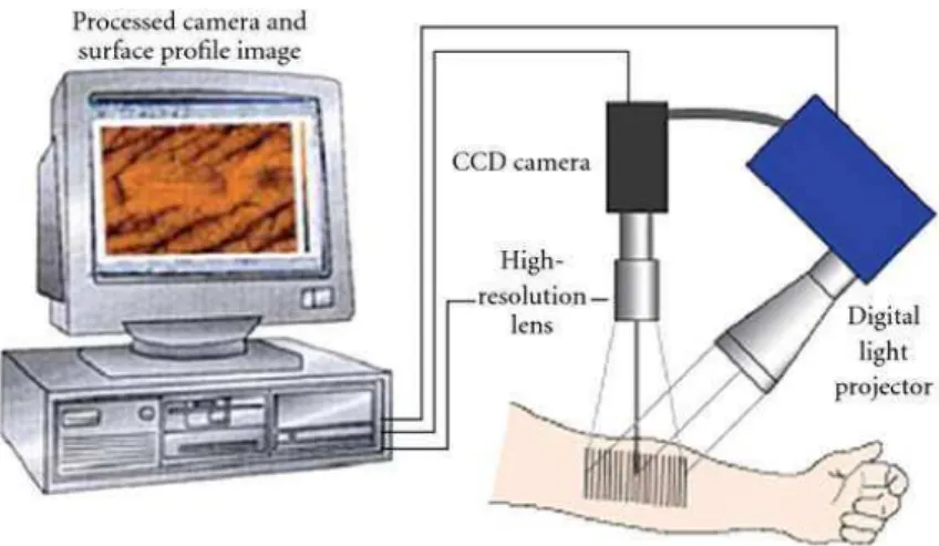 Figura 7: Medição in vivo da pele utilizando o sistema câmara primos 3D. É constituído por uma cabeça  de medição óptica livremente móvel (com um projetor micromirror integrado, um sistema de lente de  projeção e uma câmara de gravação CCD), juntamente com