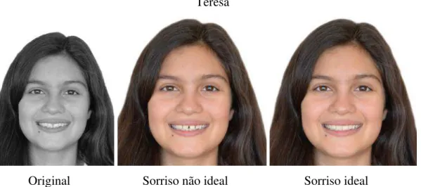 Figura 22 – Fotografias com as diferentes fases de edição fotográfica da Teresa. 