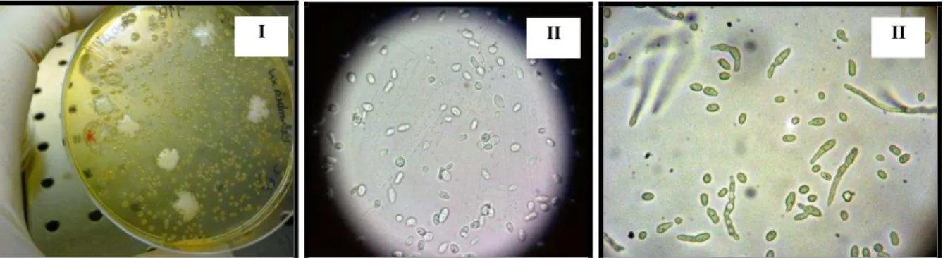 Figura  7  -  Suspeita  de  levedura  numa  amostra  de  leite  espalhada  em  meio  de  Columbia  (I)  e  observação ao microscópio 100x (II)