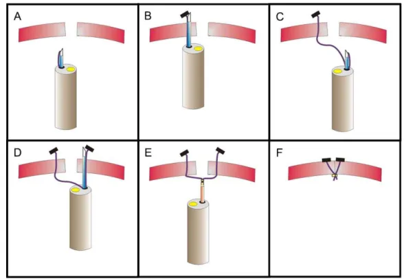 Fig. 2 – Diagram of the T-tags appliance and locking in the bladder wall. (A) Endoscopic needle approaching the edge of vesicotomy; (B) release of the first T-tag; (C) endoscopic needle approaching of the other edge of the vesicotomy; (D) release of the se