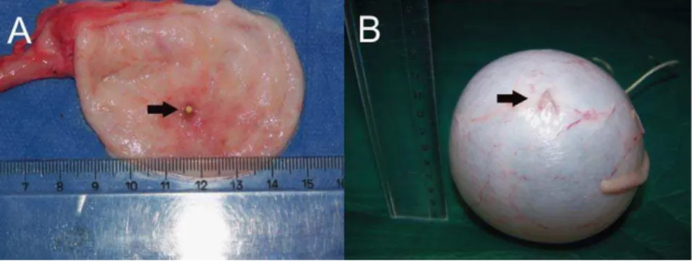 Fig. 5 – Necropsy images from the bladder after closure of a 10-mm vesicotomy. (A) Inside view showing the lock (arrow); (B) outside view showing metallic T-tags (arrow).