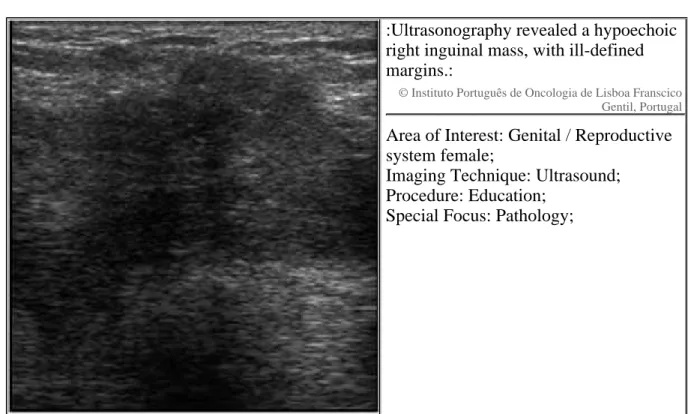 Figure 1 Ultrasound