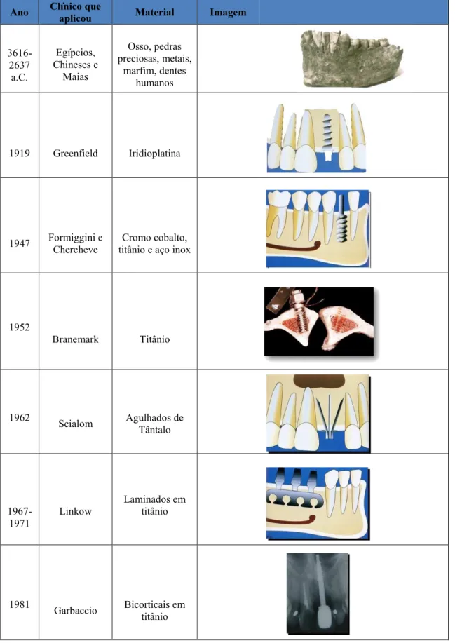 Tabela 2 Representação da evolução dos implantes, adaptado de (Coppedê, 2016; Engler-hamm et al.,  2008) 