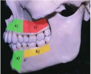 Figura 6 Imagem representativa da qualidade e  quantidade de osso na maxila e mandíbula: a) boa  qualidade e quantidade; b) quantidade insuficiente, 