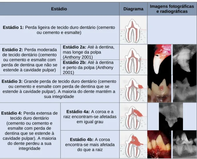 Figura 2. Imagens radiográficas dos tipos de lesões de reabsorção dentária (adaptado de  Copyright© AVDC® (2019), usado com permissão)