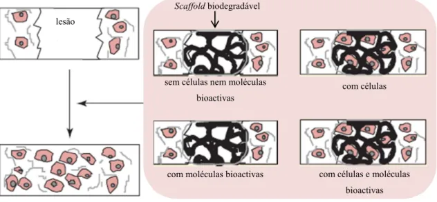 Figura  1  Uma  das  principais  metodologias  com  biomateriais  em  engenharia  de  tecidos  (adaptado  de  (Yasuhiko, 2005)) 