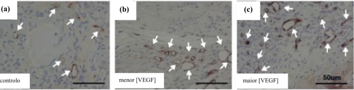 Figura  10  Implantação  de  scaffolds  de  colagénio  (b)  e  (c),  nos  quais  foram  imobilizadas  moléculas  de  factor de crescimento endotelial para regenerar uma lesão na parede ventricular de miocárdio de roedores