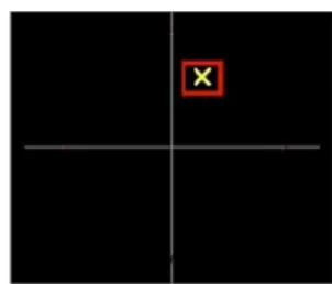 Figure 2: Example of Biofeedback display. 