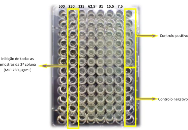 Figura 5 - Exemplo de E-test a Rhodotorula rubra (A) e Tricosporon cutaneum (B) para  fluconazol (tira FL) e anfotericina B (tira AP)