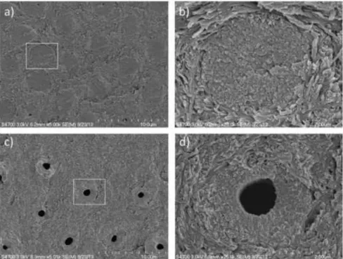 Figura 1 - Imagens obtidas por MEV de dentina jovem e envelhecida; a) dentina envelhecida ampliada  5000x; b) túbulo dentinário de dentina envelhecida ampliada 25000x; c) dentina jovem ampliada 5000x; 