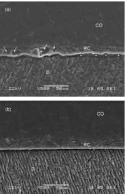 Figura  9 - (a) Utilização de cimento resinoso à temperatura ambiente: verifica-se descontinuidade na  interface cimento/dentina (asteriscos) e a presença de porosidades (setas)