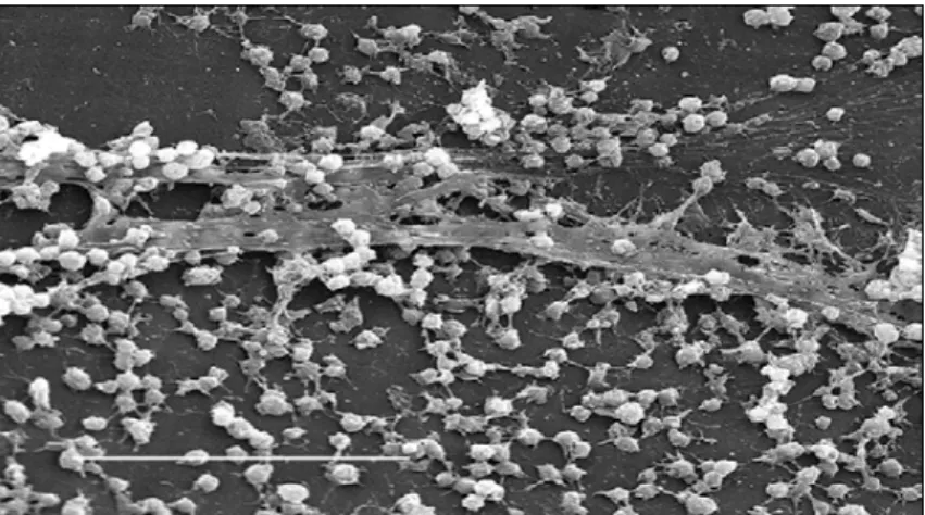 Figura 4 - Imagem de um biofilme de Staphylococcus  spp. na superfície interna de um dispositivo médico de 