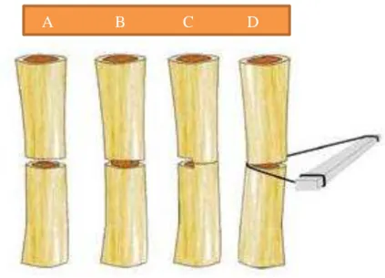 Figura 3:Métodos de separação cirúrgica dos segmentos ósseos: osteotomia completa com  incisão do periósteo (A), corticotomia preservando a medula e osso esponjoso (B), osteotomia incompleta 