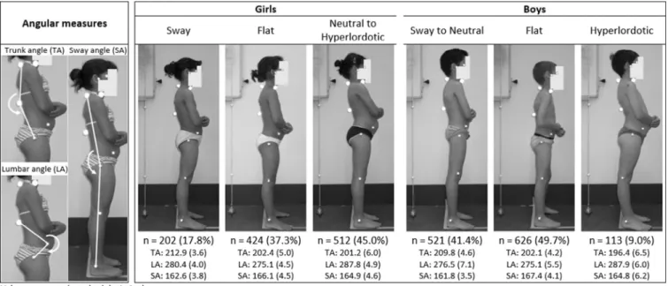 Fig. 1. Individual angular measures used to identify pediatric sagittal postural patterns using Mplus latent profile analysis (left panel), and a typical member of each pattern shown separately for girls and boys (right panel).