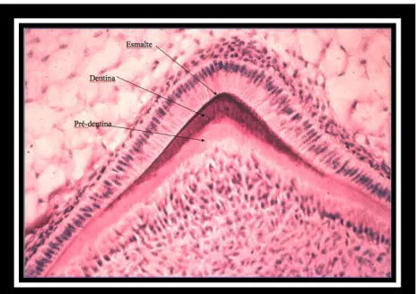 Figura 5- Fase inicial do processo de formação do esmalte 