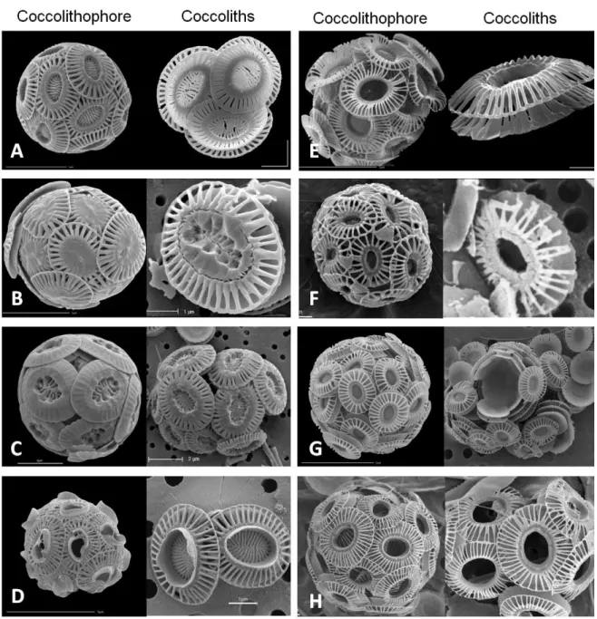 Figure  2  -  Scanning  electron  microscopy  of  the  different  morphotypes  and  coccoliths  present  in Emiliania  huxleyi
