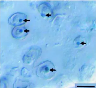 Figure 8 - I. galbana cells stained with Sudan Black B dye showing the lipid droplets accumulated  intracellularly (arrows)
