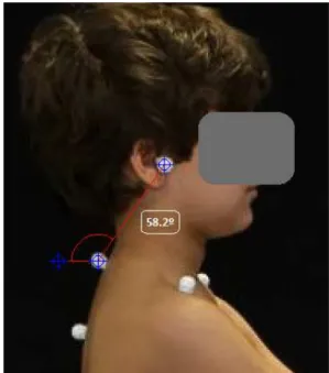 Fig. 12. Medição da postura da cabeça no plano sagital. 