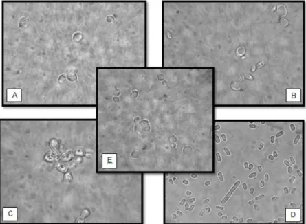 Figura  1.1.  Fotografias das leveduras de alteração estudadas em vinho tinto em microscópio óptico