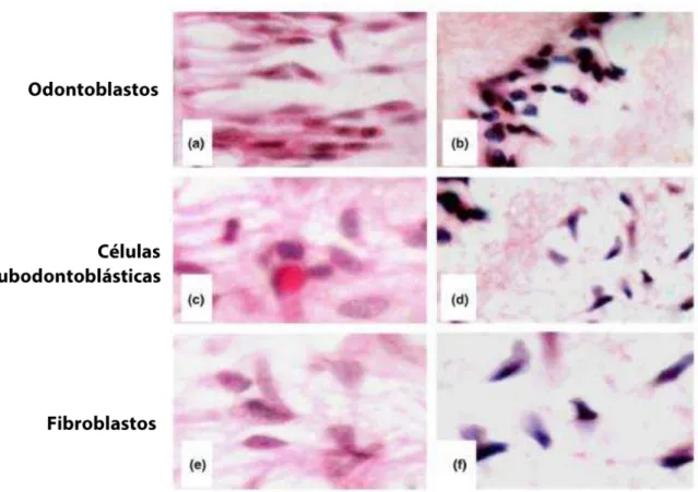 Figura  8 –   Imagens  de  microscopia  óptica  de  cortes  histológicos  (Hematoxilina-Eosina)  que  mostram  as  características histomorfológicas de odontoblastos, células subodontoblásticas e fibroblastos pulpares de 2 grupos: 