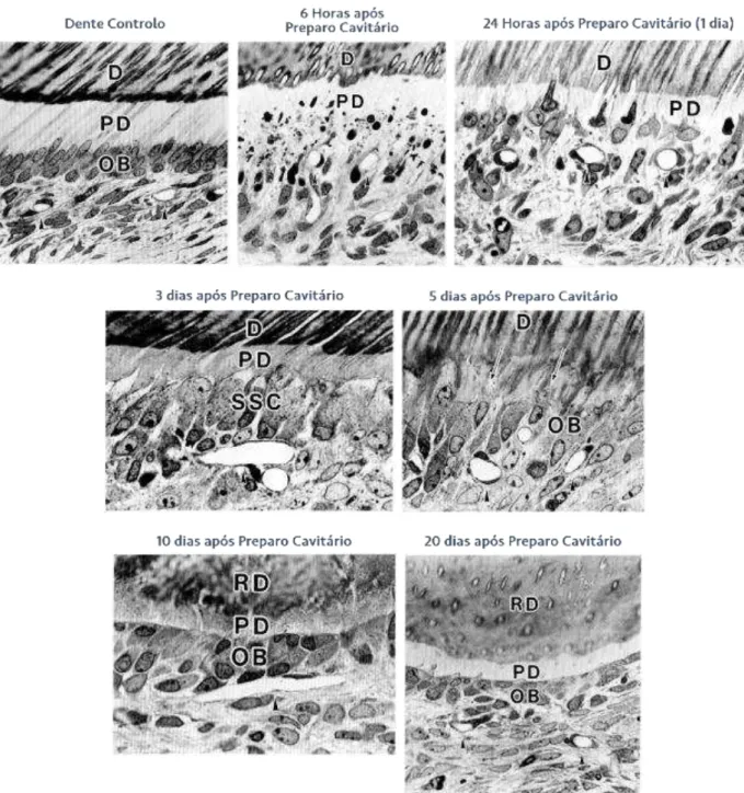 Figura  9 –   Resposta  e  alterações  ultraestruturais  da  camada  odontoblástica  e  capilares subodontoblásticos  após  a  preparação  cavitária  de  molares  de  rato