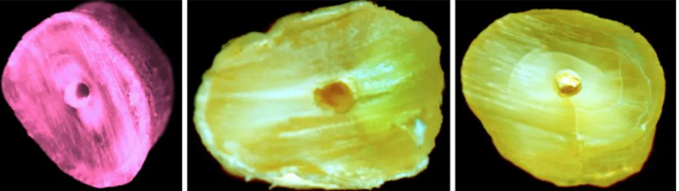 Figura 1 : Imagens obtidas por microscópio binocular ilustrando defeitos dentinarios (no  ordem : linhas, fissura parcial, fissura completa) (Adaptado de Monga et al., 2015) 
