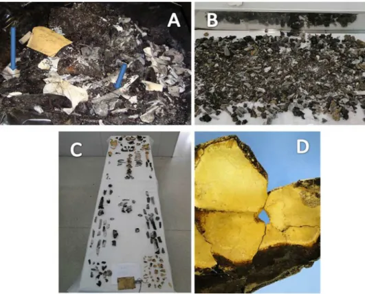 Fig. 5. Case 4. (A) Cadaveric remains found in a slum. Arrow points the tire metal belt