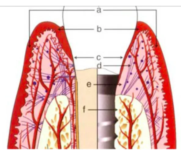 Figura 9 - Comparação da anatomia periodontal e periimplantar dos tecidos moles (Adaptado de: Sclar,  2003) 