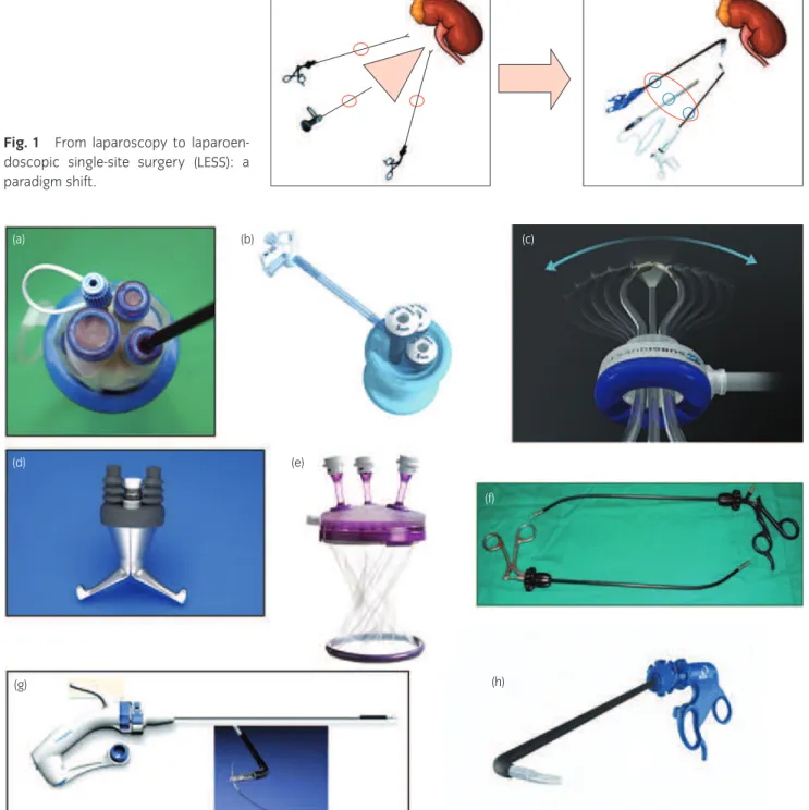 Fig. 1 From laparoscopy to laparoen- laparoen-doscopic single-site surgery (LESS): a paradigm shift